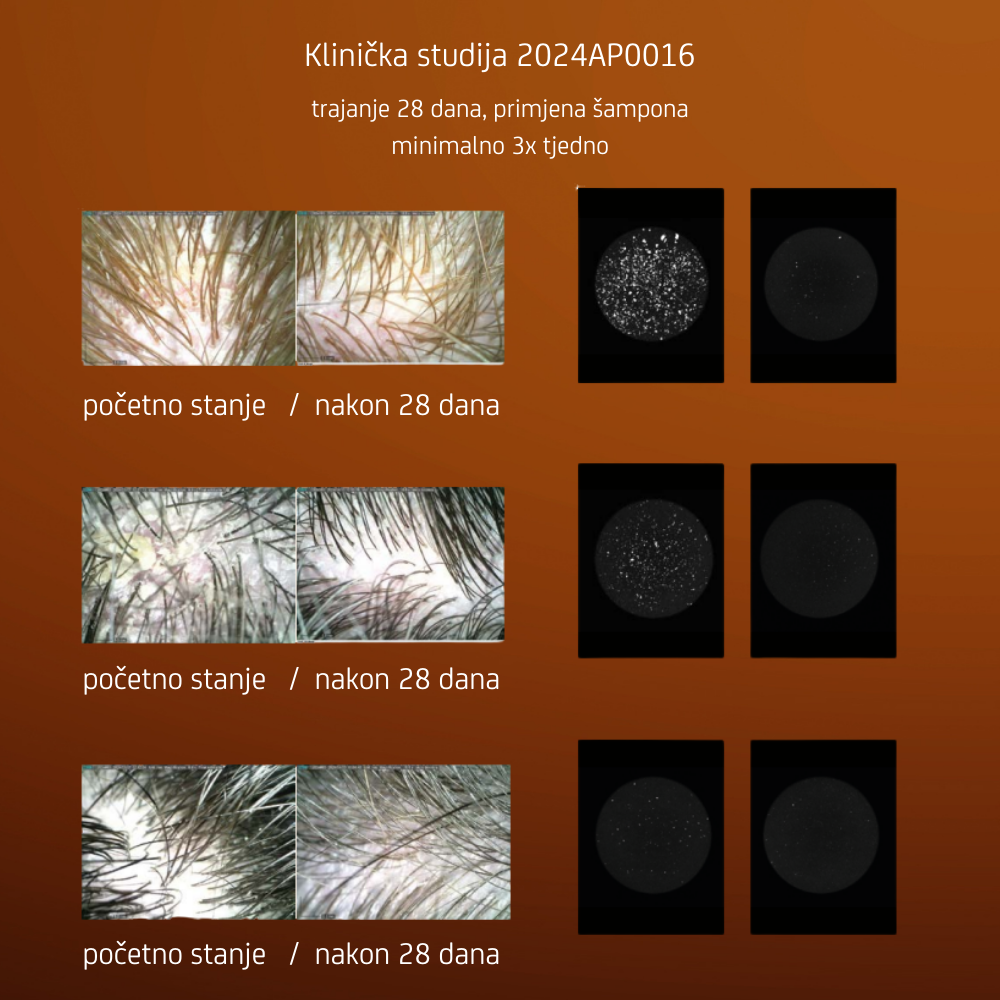 Nuggela & Sulé | Anti-Dandruff Šampon